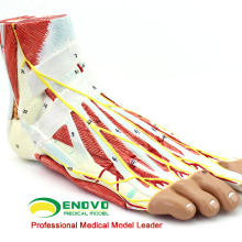 MUSCLE11(12035) Medical Anatomical Foot Model with 9-Parts Removable Muscle and Vessels 12035